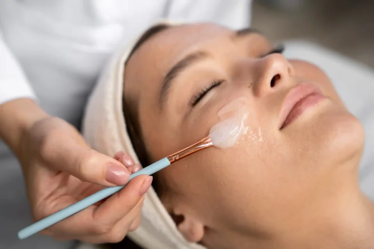 Peeling Quimico Facial