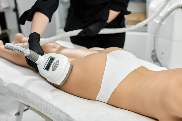 Tratamiento De Criolipolisis En Madrid